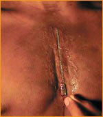 Reel F/X Zipper Prosthetic